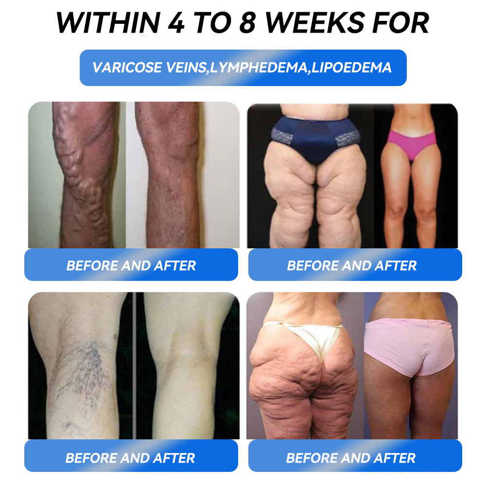 【specialty store】IFMAGIC® GLP-1 Pro Weight Loss Oral Solution 7 days visible effect, no side effects, suitable for all age groups👨🔬