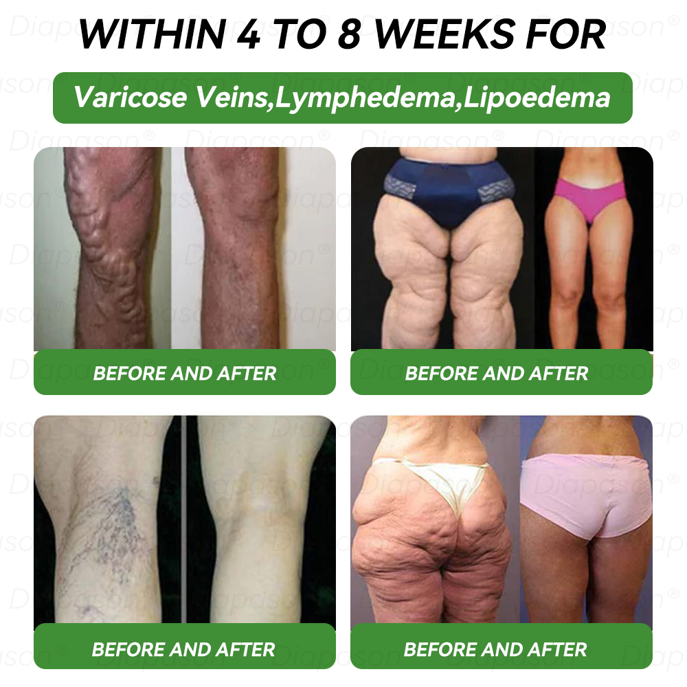 Official Store | 𝐃𝒊𝓪𝐩𝓪𝙨𝐨𝒏®USGLP-1 Six-in-One Health Solution Oral Liquid (Just once a day, visible changes in 7 days) For obesity, cardiovascular health, diabetes, sleep apnea, Gut Health, joint issues, and more