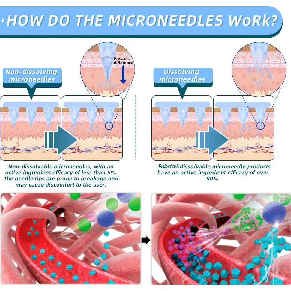 【Genuine Preferred🥇】Lmipki® NIDDK-Tirzepatide Nano Microneedle Patch 🇺🇸🧀（Zero Pain, 24/7 Release | Lose 20lbs FAST | 90% Sugar Drop | ）